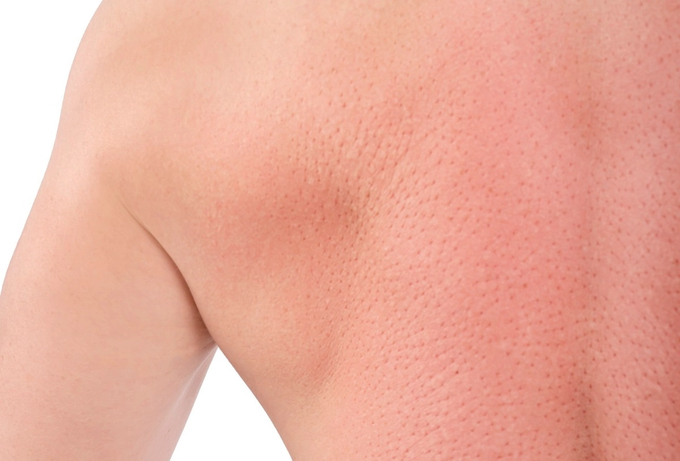 Акупунктурный массаж